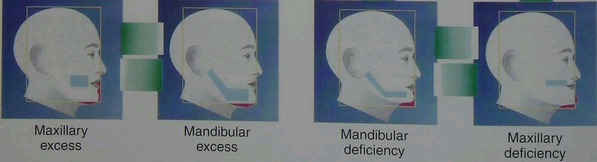 牙颌面畸形及正颌外科手术简介