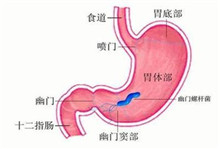 幽门螺杆菌感染_疾病库_疾病查询_疾病大全_