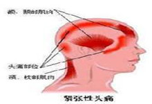 紧张性头痛