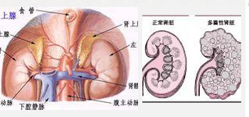 检查项目:  常见症状:  简介                利德尔综合征(liddle