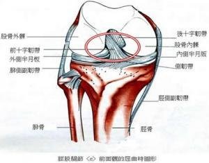 后十字韧带损伤