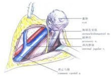 甲状腺舌管囊肿与瘘