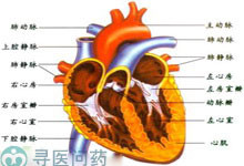 心室肌致密化不全