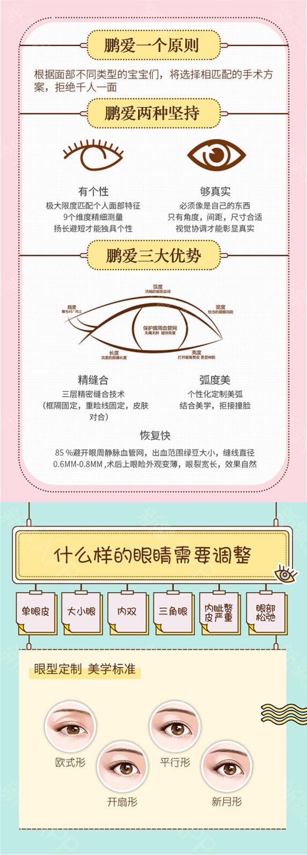 埋线双眼皮_07.jpg