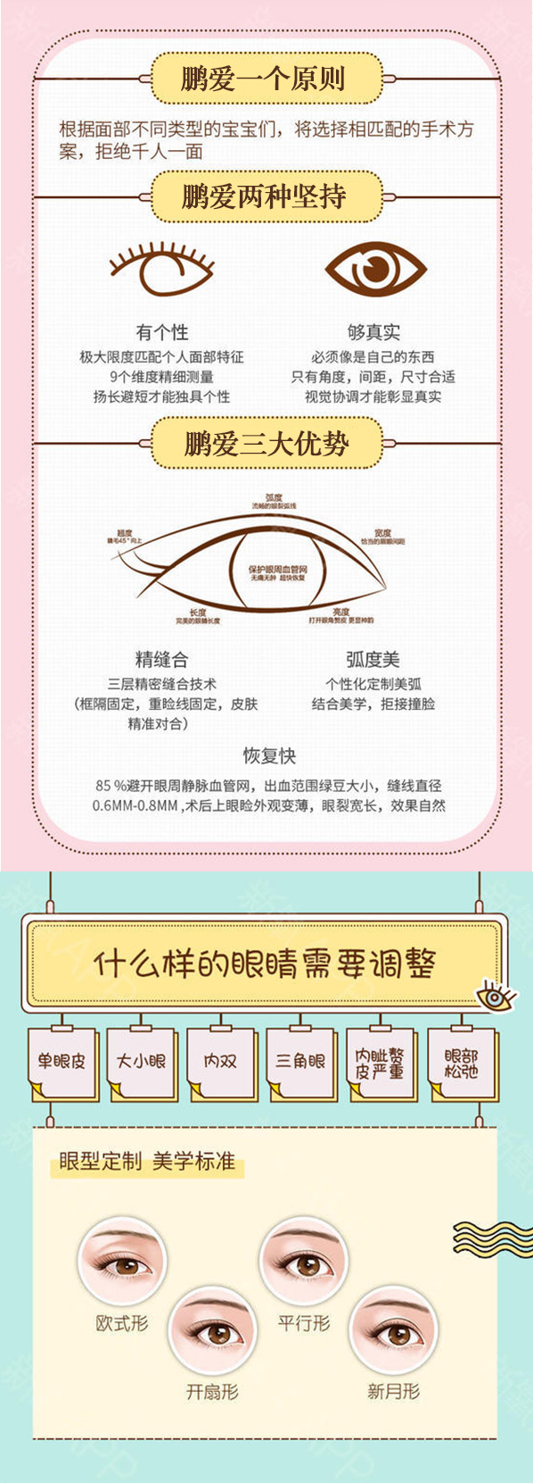 埋线双眼皮_07.jpg