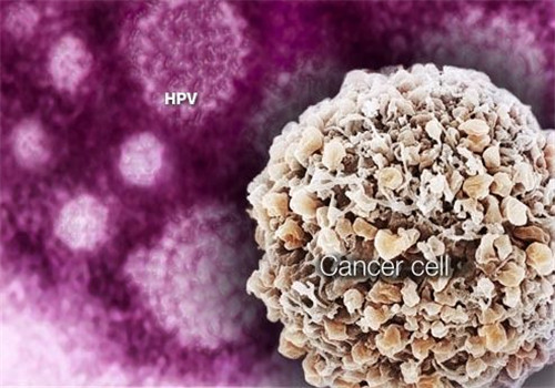 hpv病毒,宫颈癌