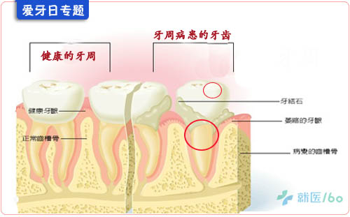 牙龈分游离龈(围绕牙颈部但不与牙体附着的游离可动部分),附着龈,牙间