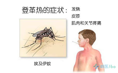 登革热症状,登革热