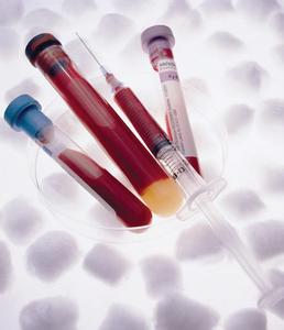 血库储备是怎样的?18 人受伤就告急?