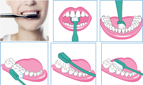 关注牙周健康,提高生活质量_健康资讯_就医160网_网上预约挂号统一平台