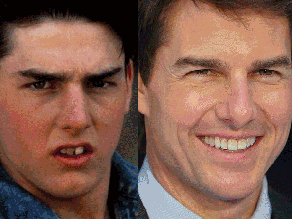 (一颗一颗牙齿清洁,请别偷懒~~)