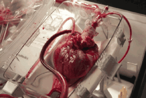 人工心脏,是怎么运行的?