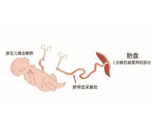 脐带血干细胞有哪些功效_健康资讯_就医160网