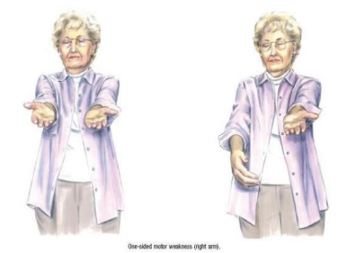 【名医访谈】家里老人中风了该怎么办?_健康