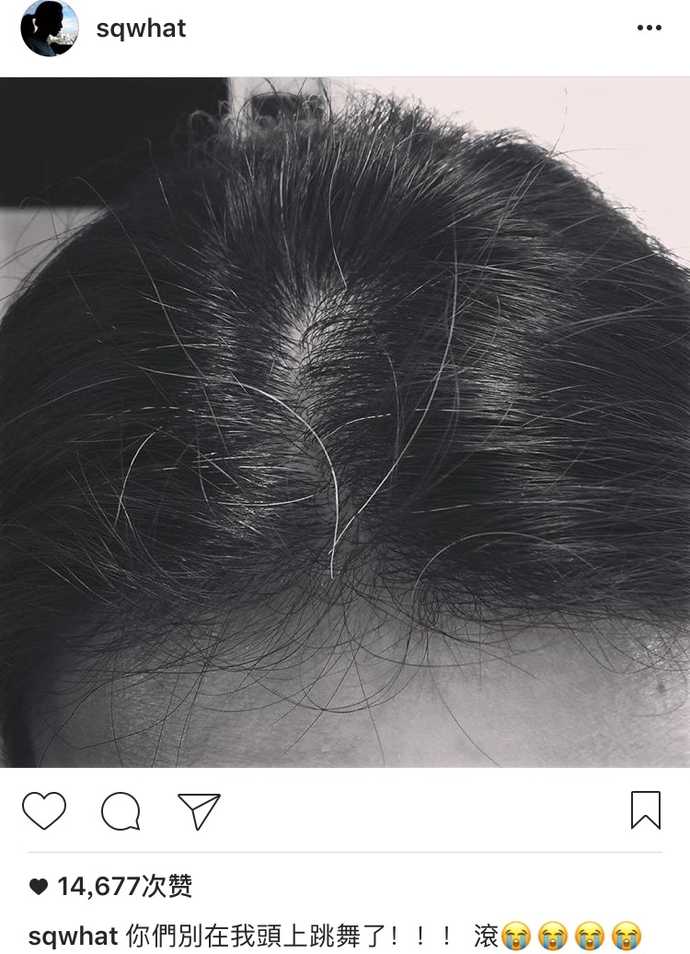 舒淇居然长白发了!想让秀发长存要这么做