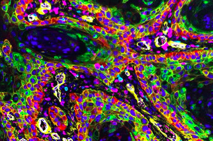 令人震撼的癌细胞特写照,发现和分析癌细胞方式将彻底