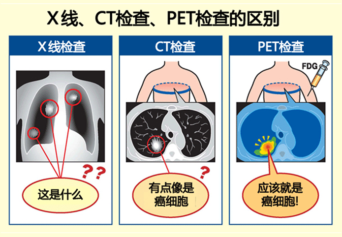 pet-ct