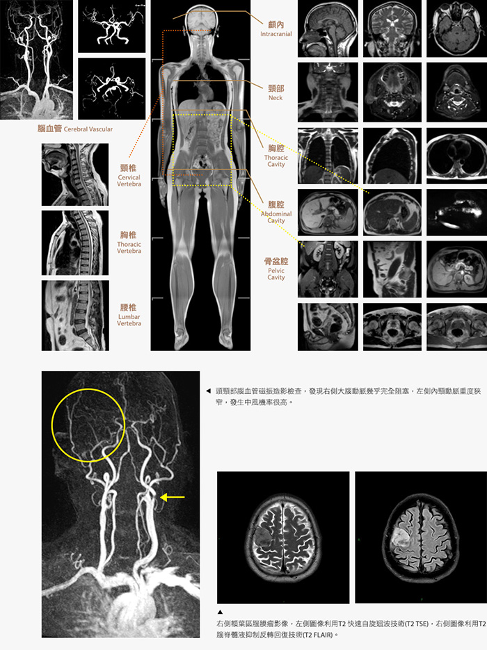 MRI造影实例