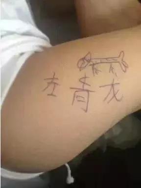 原来激光治疗纹身是这个样子的