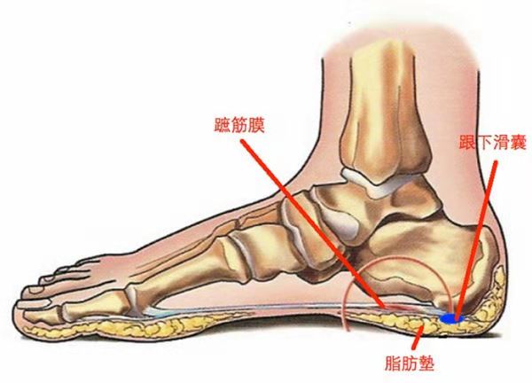 简单的说就是「过度使用」使得足底肌腱产生发炎现象,通常这种情形亦