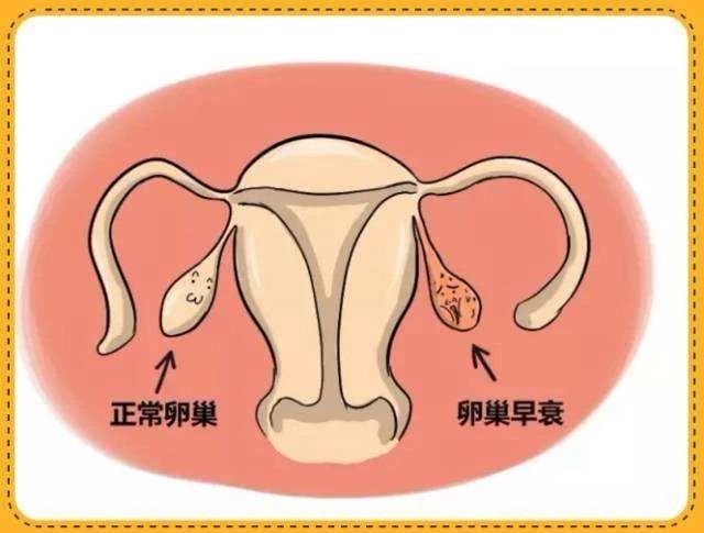 【女性健康】这6种行为容易引起卵巢早衰,要注意了!