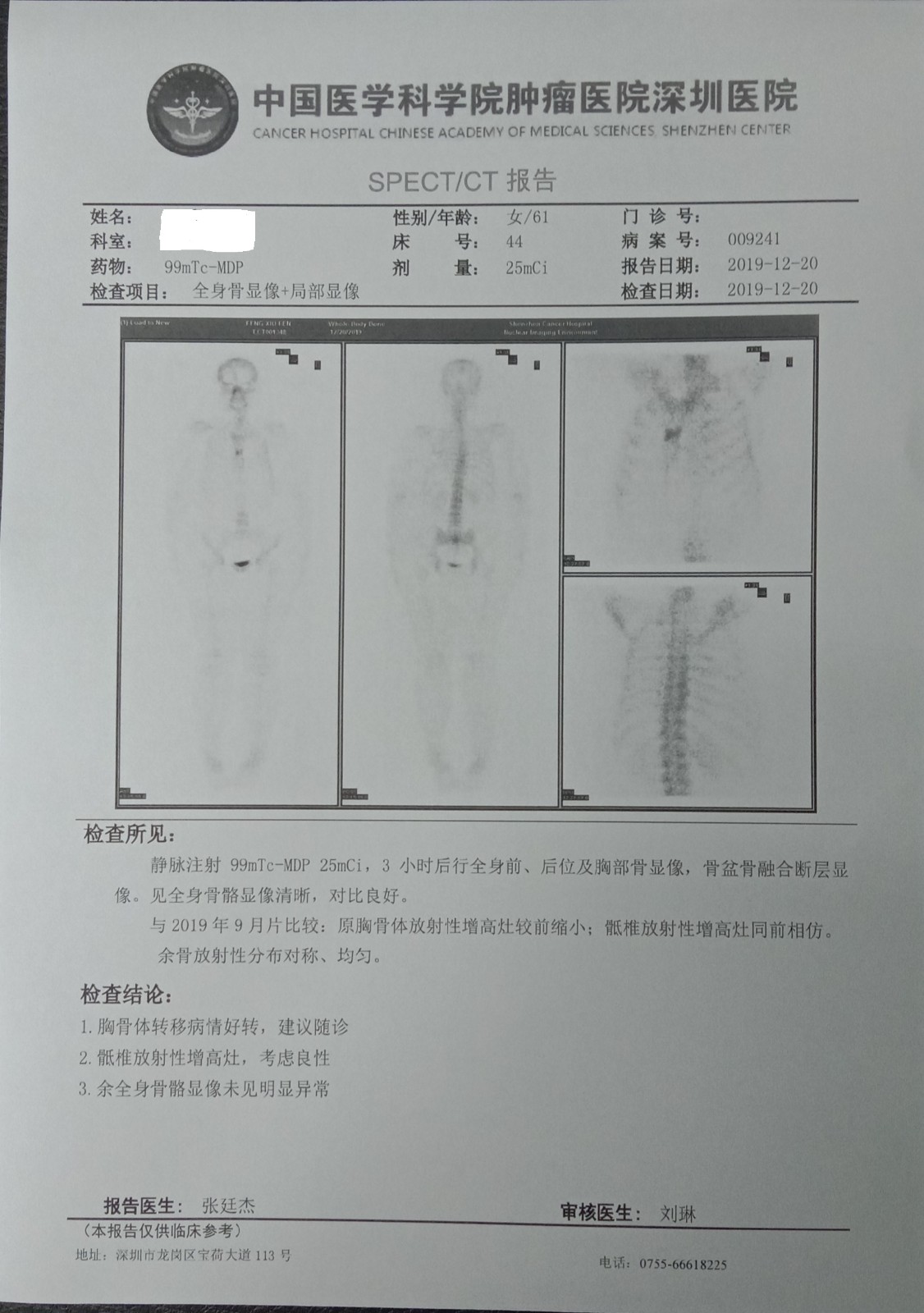 冯秀芬 骨转移好转报告单.jpg