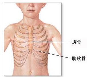 漏斗胸常见问题