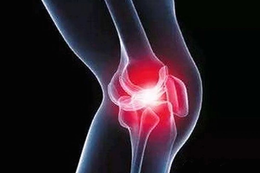 膝关节疼痛的原因有很多,痛风可能是其中的一个病因,因此,当膝关节