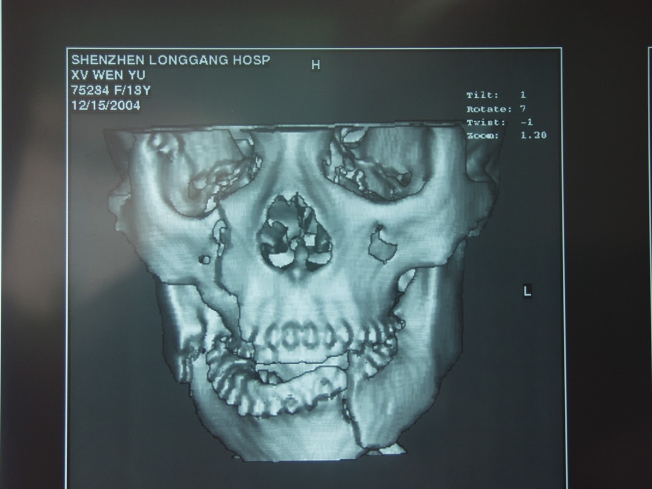 外伤的诊治,口腔颌面部肿瘤切除包括上下颌骨良性及恶性肿瘤切除术