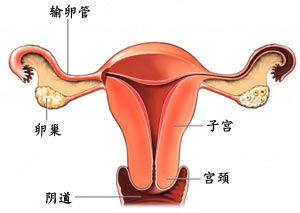 妇科炎症