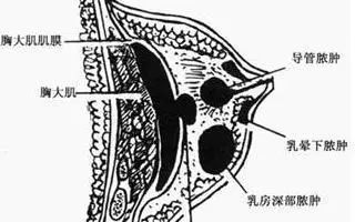 不容忽视的非哺乳期乳腺炎:肉芽肿性乳腺炎