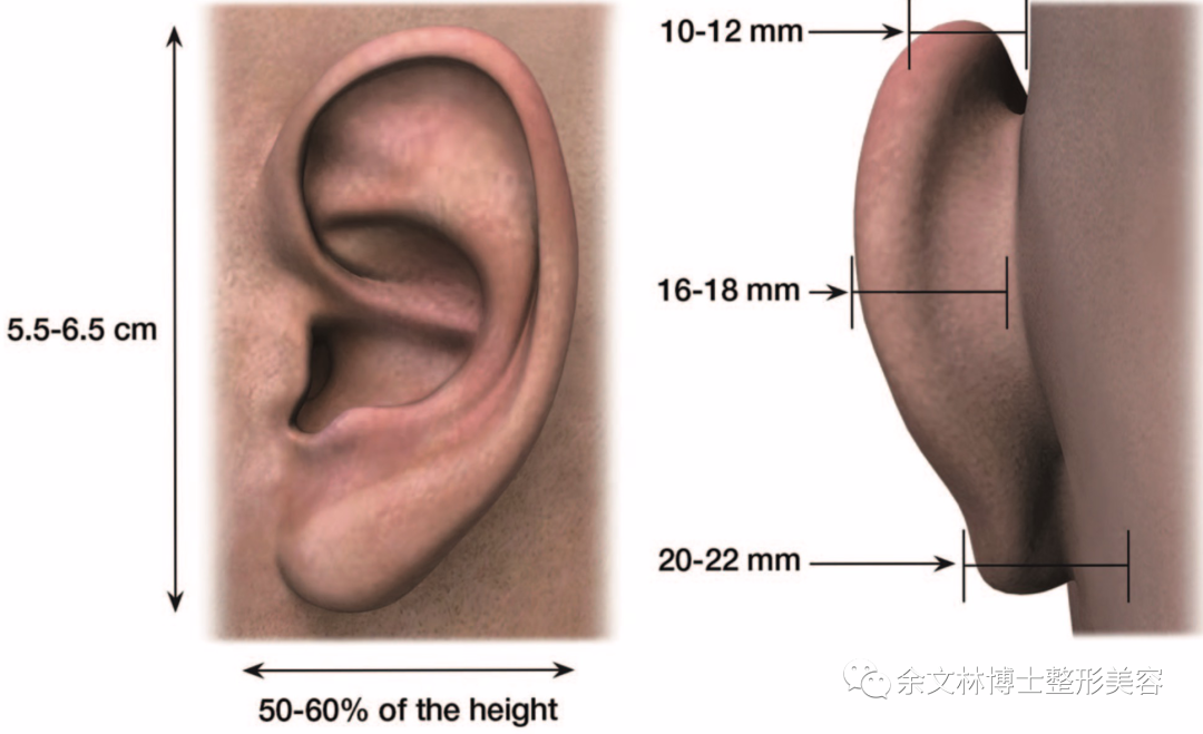 耳轮到乳突的距离小于20mm,耳舟和耳甲的夹角小于90度.
