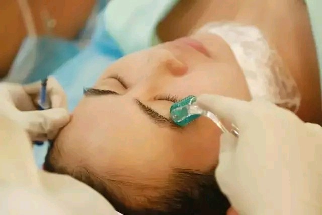 3.微针真人体验