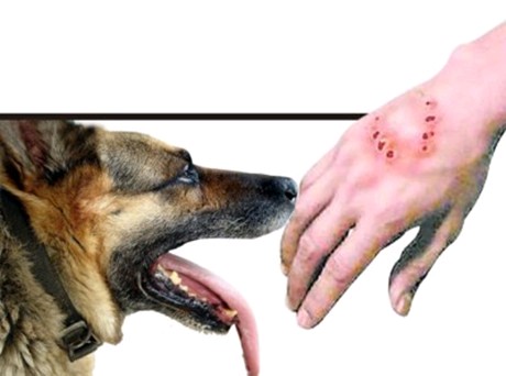 关于狗咬伤的那些事一贴讲清楚