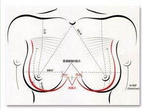 中需要测量数据有 乳房基底宽度