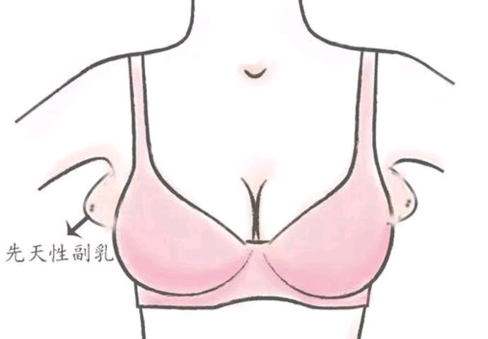 正常的乳头突出图片