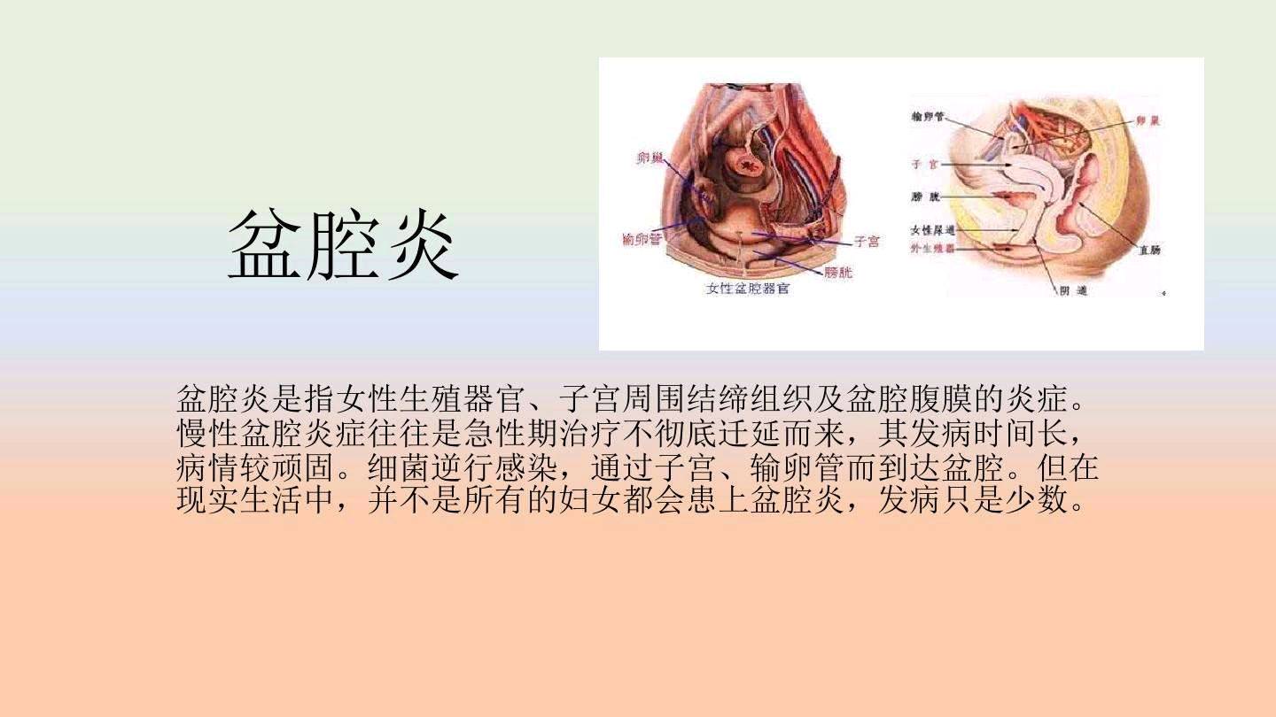 女性盆腔炎的主要症状有哪些？得了盆腔炎如何治疗呢？