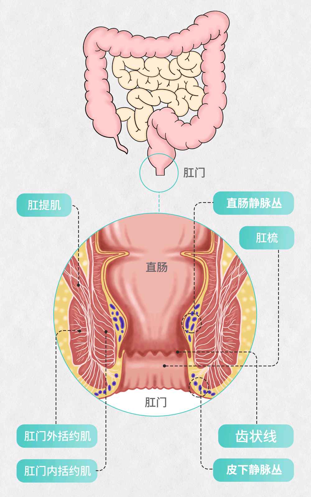 痔疮女性 图解图片