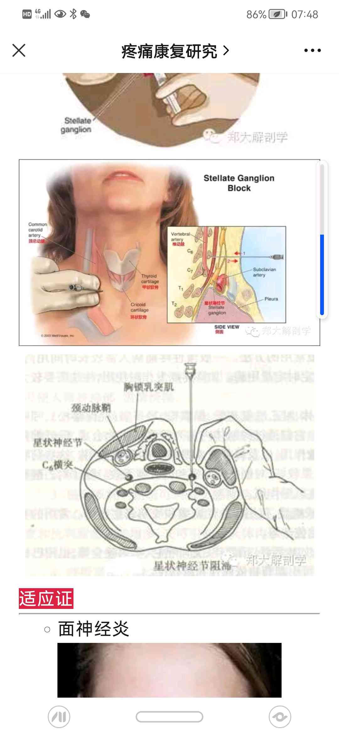 一觉醒来“毁容了”！？得了面瘫该怎么办？！_澎湃号·政务_澎湃新闻-The Paper