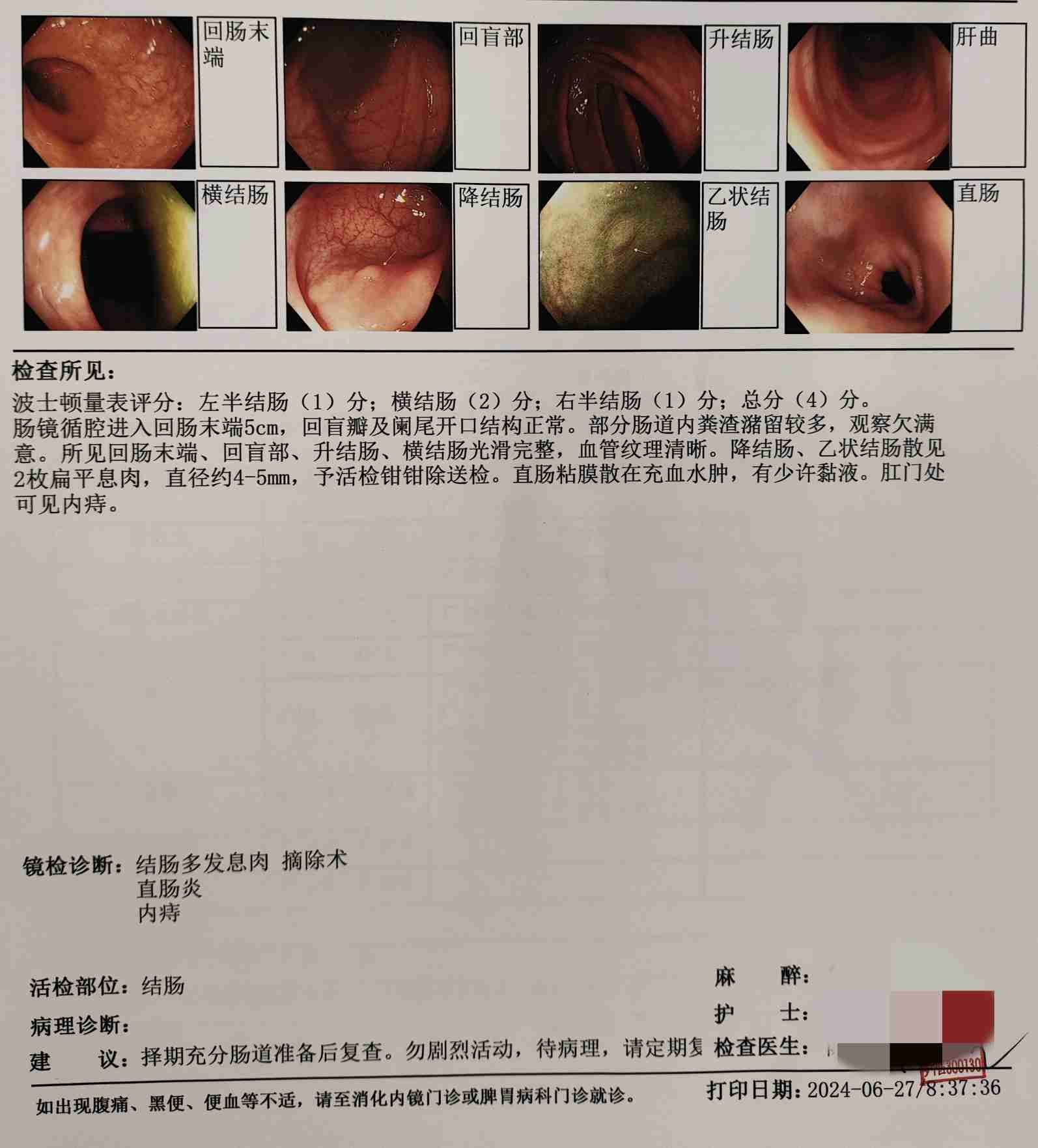 结肠息肉的人越来越多，你选择无动于衷？还是有所作为？