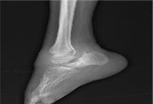 什么叫周围神经病 JY160_20140819_1408444277.jpg