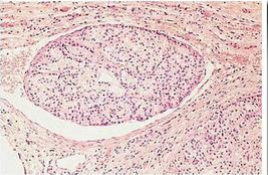 急性上呼吸道感染最常见的致病微生物 JY160_20140819_1408463373.jpg