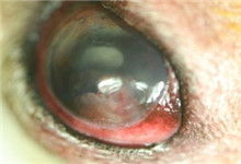 什么是黑色素瘤是怎么引起的 JY160_20140831_1409460482.jpg