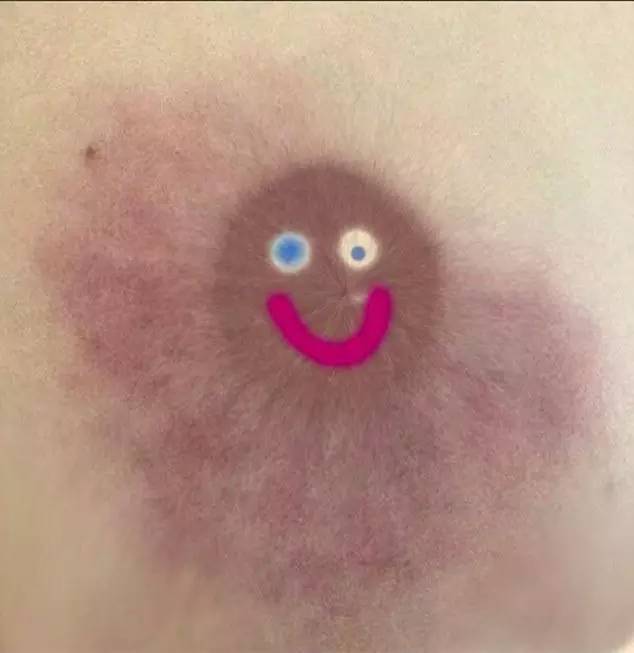 她勇晒乳房照 为女性敲警钟
