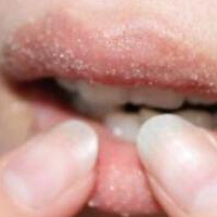 拒绝春季干裂嘴唇 我要娇嫩红唇