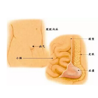 了解这种常见病，或许能少些悲剧