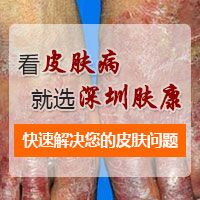 2016夏季皮肤健康公益普查活动启动