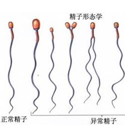 人会生病，精子也会！孕前先给精子把把脉