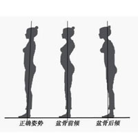 椎间盘膨出怎么治疗