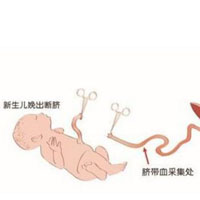 脐带血干细胞有哪些功效